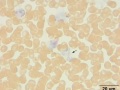 "Gray" eosinophil & neutrophil (CAE)