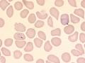 Distemper (Wrights)