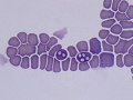 Babesia canis