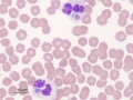 Anaplasma phagocytophilum
