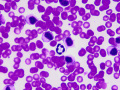 GL-CLL (rapid stain)