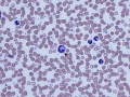 Hepatozoon