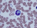 Hepatozoon