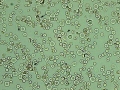 IMHA (wet prep)
