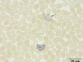 Control eosinophil & neutrophil (SBB)