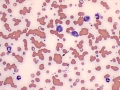 Agglutination