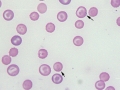 Babesia gibsoni