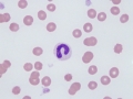 Band neutrophil