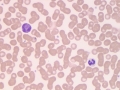 Eosinophil & basophil