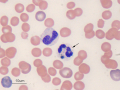IMHA (sideroleukocyte)