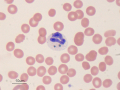 Sideroleukocyte