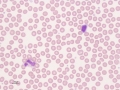 Eosinophil & lymphocyte