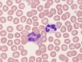 Neutrophil & eosinophil
