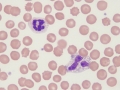 Neutrophil & "gray" eosinophil