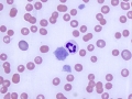 Macroplatelet
