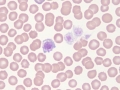 Macroplatelet