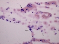 Mast cells