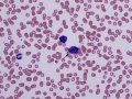 Mast cells