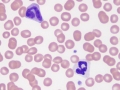 Neutrophil & monocyte