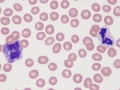 Neutrophil & monocyte