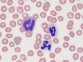 Neutrophils & monocyte
