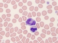 Neutrophil & monocyte