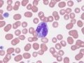 Monocyte