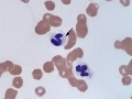 Mycobacteria