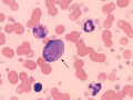 Progranulocyte