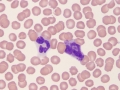 Neutrophil & basophil
