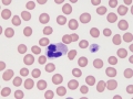 Platelet & neutrophil