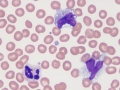 Neutrophil & monocytes