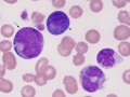 Promonocyte