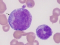 Promonocyte