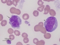 Promonocyte