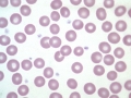 RBC & platelets