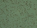 IMHA (wet prep)