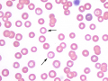 Torocytes