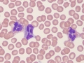 Eosinophil & basophil