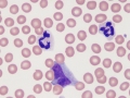 Neutrophil & monocyte