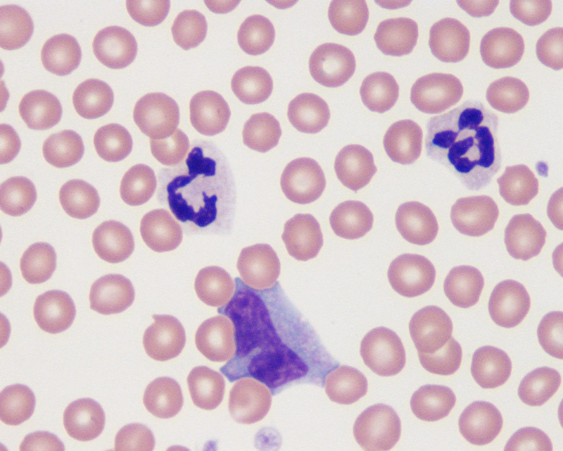 Neutrophil & monocyte