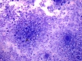 Chronic myeloid leukemia (CML, dog)