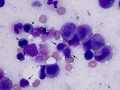 Leukemia of granular lymphocytes (dog)