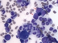 Atypical CML (dog, marrow)