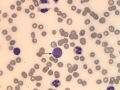 Atypical CML (dog, VB)