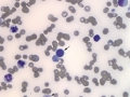 Atypical CML (dog, VB)