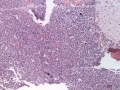 Atypical CML (H&E, dog, marrow)