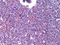 Atypical CML (H&E, dog, marrow)