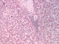 Atypical CML (H&E, dog, liver)