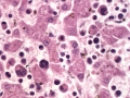 Atypical CML (H&E, dog, liver)